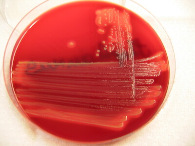 Kolonien von Staphylococcus aureus auf einer Blutagarplatte